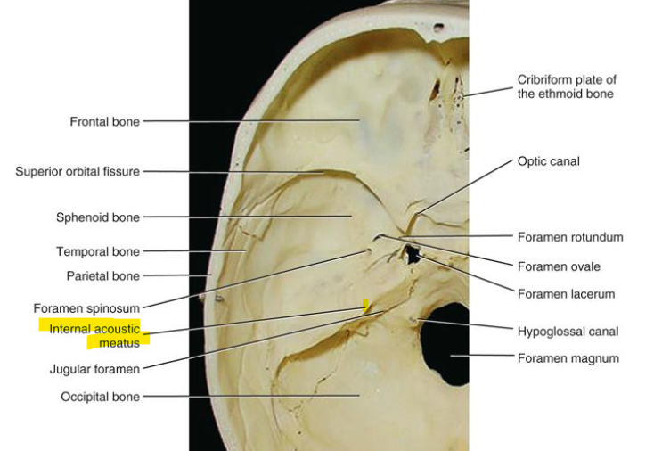 <p>CN 7(facial) and CN 8 (vestibulocochlear) </p>