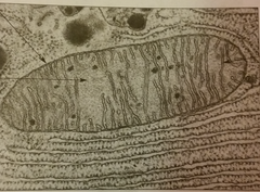 <p>The outer membrane of the mitochondria.</p>