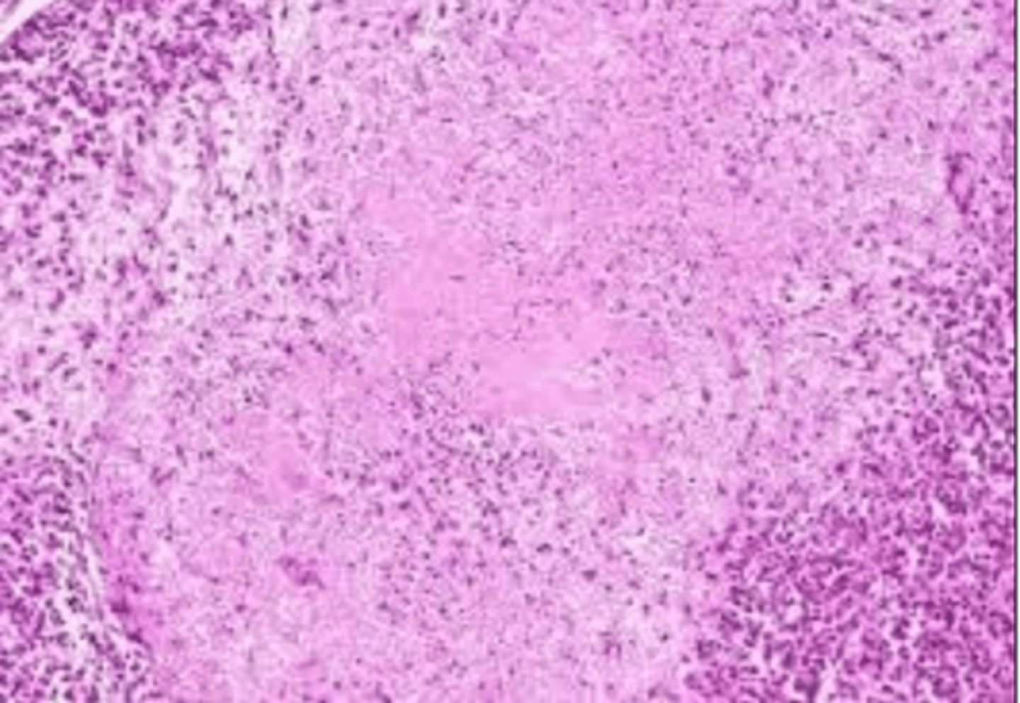 <p>what type of exudate is shown microscopically?</p>