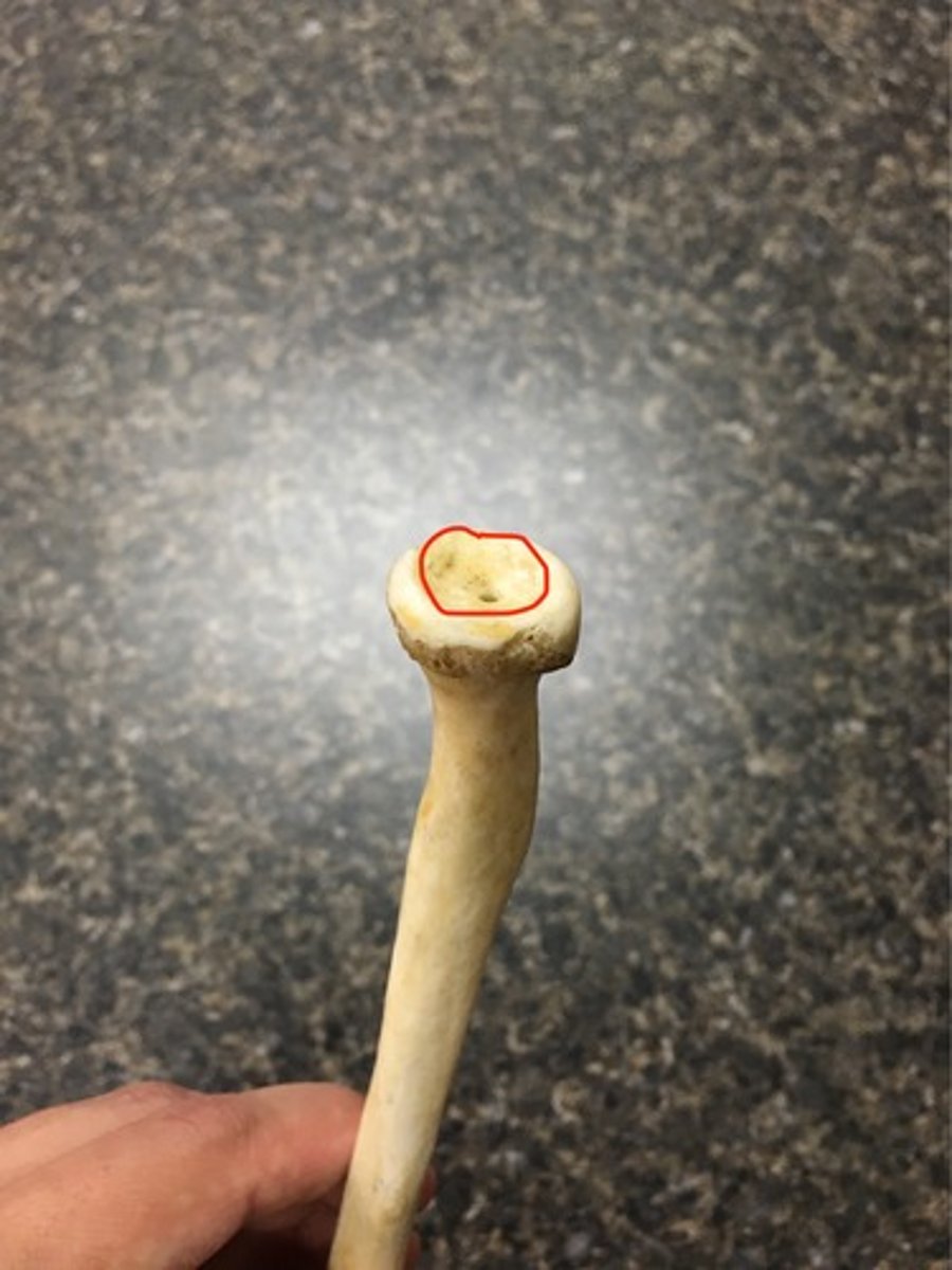 <p>part of the head of the radius that articulates with the capitulum of the humerus</p>
