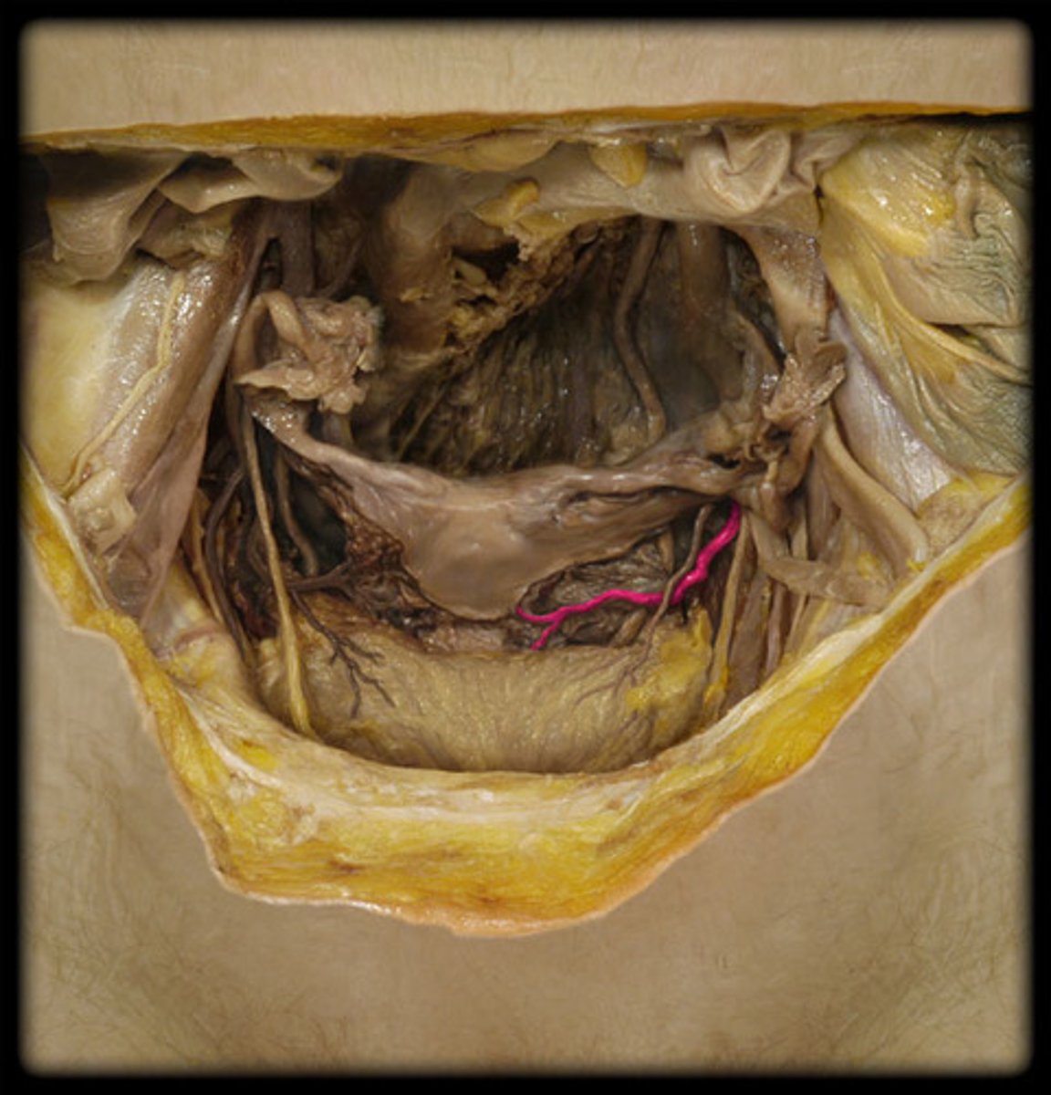 <p>The uterine artery.</p>