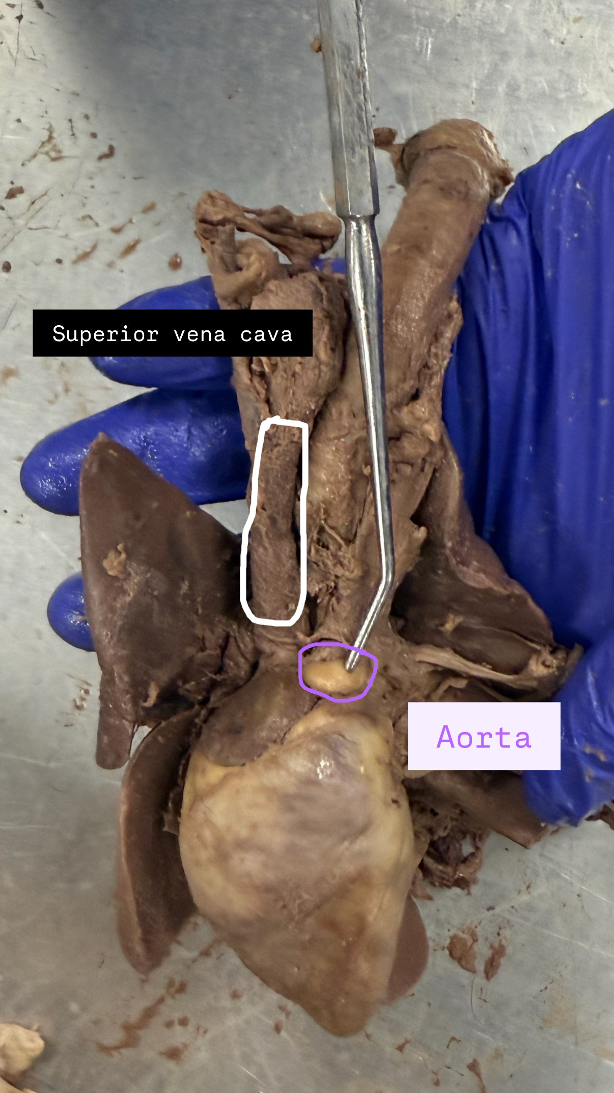 <p>superior Vena Cava, Aorta</p>