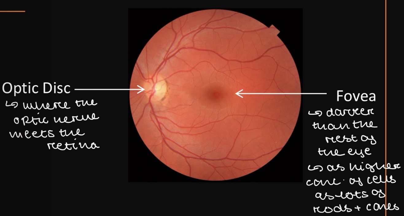 <ul><li><p><strong>Optic disc</strong> » where the optic nerve meets the retina</p></li><li><p><strong>Fovea</strong> » darker than the rest of the retina as high concentration of rod and cone cells </p></li></ul><p></p>