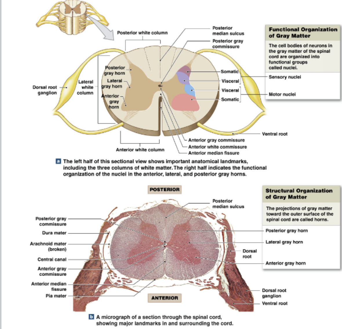 <p>Gray Matter:</p><ul><li><p>cell bodies + dendrites </p></li></ul><ul><li><p>organized into <strong>nuclei = </strong>collection of cell bodies in CNS</p></li><li><p><strong>dorsal horns</strong>: (sensory)</p><ul><li><p><u>somatic and visceral</u> sensory nuclei</p></li><li><p>process/ relay sensory information </p></li></ul></li><li><p><strong>ventral horn</strong>: (motor)</p><ul><li><p>efferent </p></li><li><p><u>somatic motor</u> nuclei </p></li><li><p>integrate / relay motor information </p></li></ul></li><li><p>Lateral horns: (motor)</p><ul><li><p><u>thoracic and lumbar</u> only</p></li><li><p><u>visceral motor</u> nuclei</p></li></ul></li></ul><p></p><p>White Matter</p><ul><li><p>organized into <strong>columns</strong></p></li><li><p>anterior, posterior, and lateral columns</p></li><li><p>each column contains <strong>tracts</strong></p></li><li><p><strong>Tracts = </strong>bundles of axons with similar structure and function</p><ul><li><p>relay info up and down spinal cord.</p></li></ul></li></ul><p></p><p><strong>Commissures</strong>: both white and gray, axons which cross sides </p>