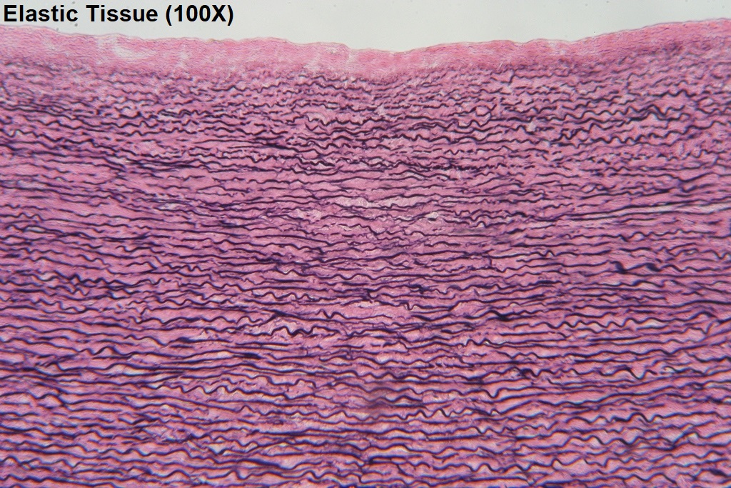 <p>Elastic tissue</p>