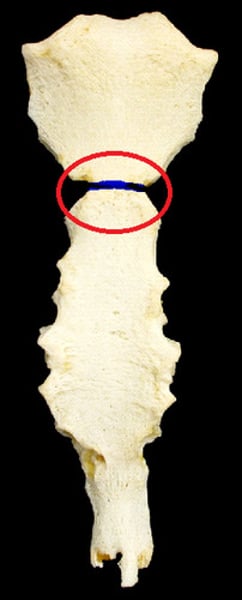 <p>junction between the manubrium and the body (articulates with 2nd rib)</p>