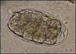 <p>Hookworms transmitted through skin penetration, ingestion, or transmammary routes, leading to anemia and melena.</p>