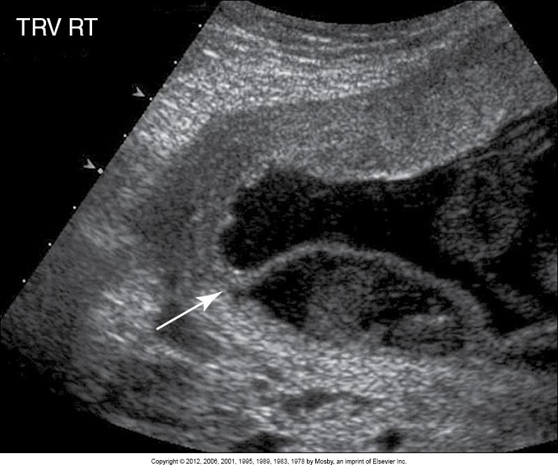 <p>What does this image show?</p>