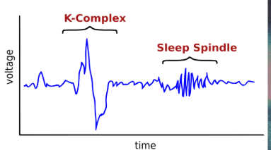 <p>NREM Stage N2 (Light Sleep) </p>
