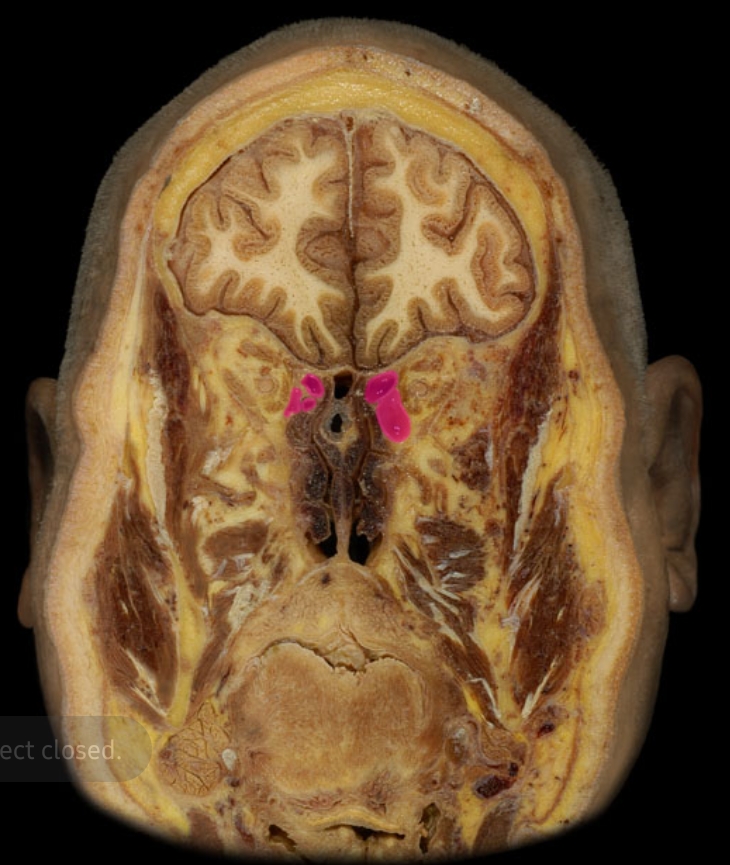 term image
