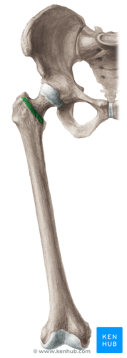 <p>linea intertrochanterica</p>