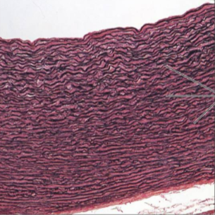 <p>what is the connective tissue?</p>