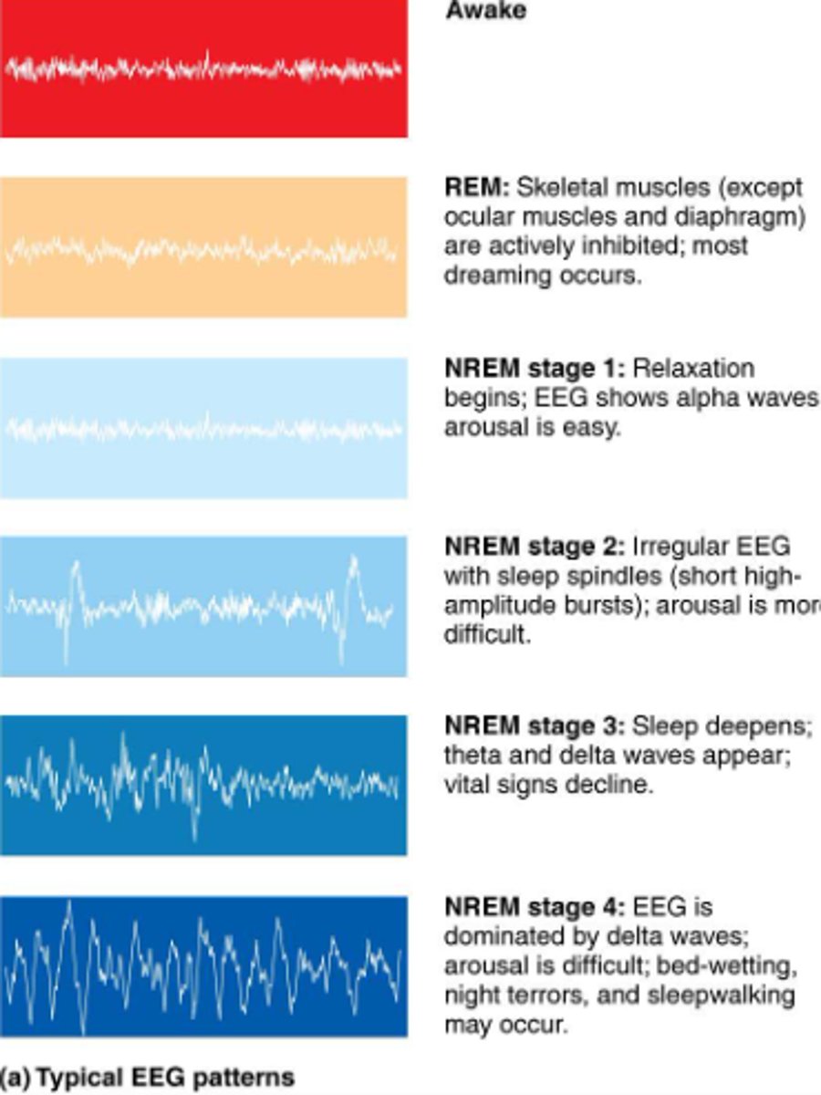 <p>A stage of sleep characterized by rapid eye movements, vivid dreams, and muscle paralysis</p><p>- active brainwaves, increased heart rate and blood pressure, limp muscle state</p><p>- 80% of REM is dream sleep</p><p>- Alternates on 90 minute cycles</p>