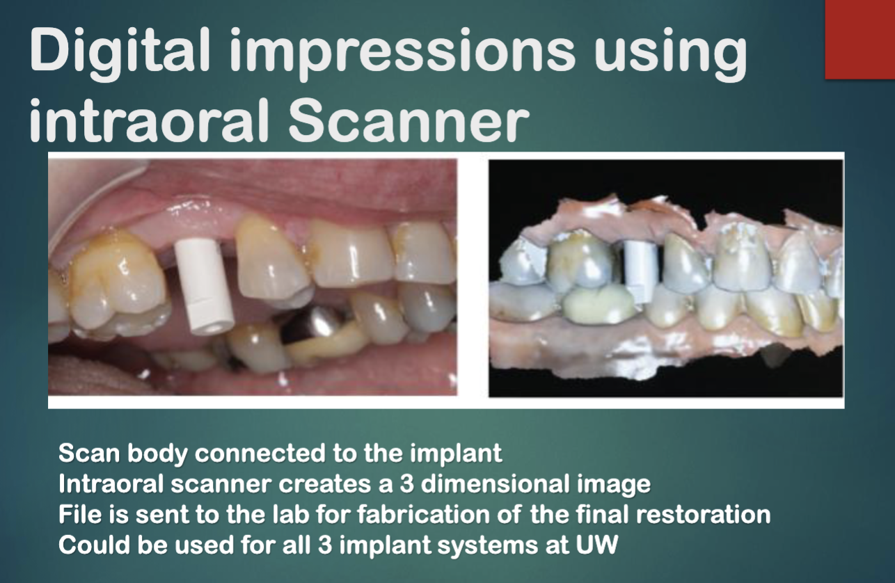 <ul><li><p>intraoral scanner </p></li><li><p>sending electronic STL files to labs for fabrication of implant restorations </p></li><li><p>emergence profile and design done by lab </p></li><li><p>restoration sent to you for insertion </p></li></ul><p></p>
