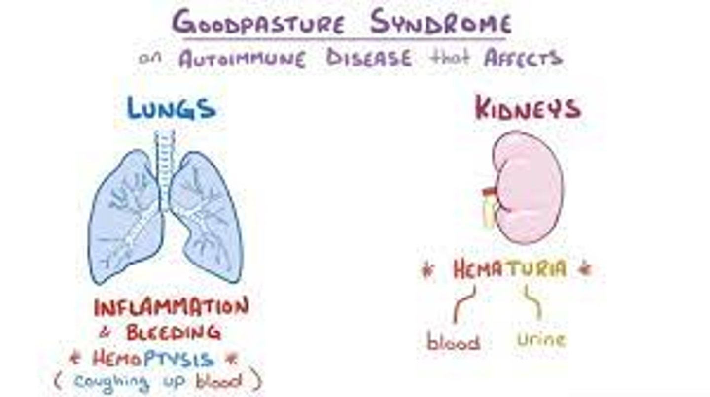 <p>hemoptysis</p><p>tachypnea</p><p>malaise</p><p>anorexia</p><p>HA</p><p>may have preceding URI</p><p>HTN and edema (components of nephritis syndrome)</p>