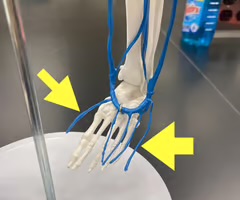 <p>Name the blood vessel.</p>