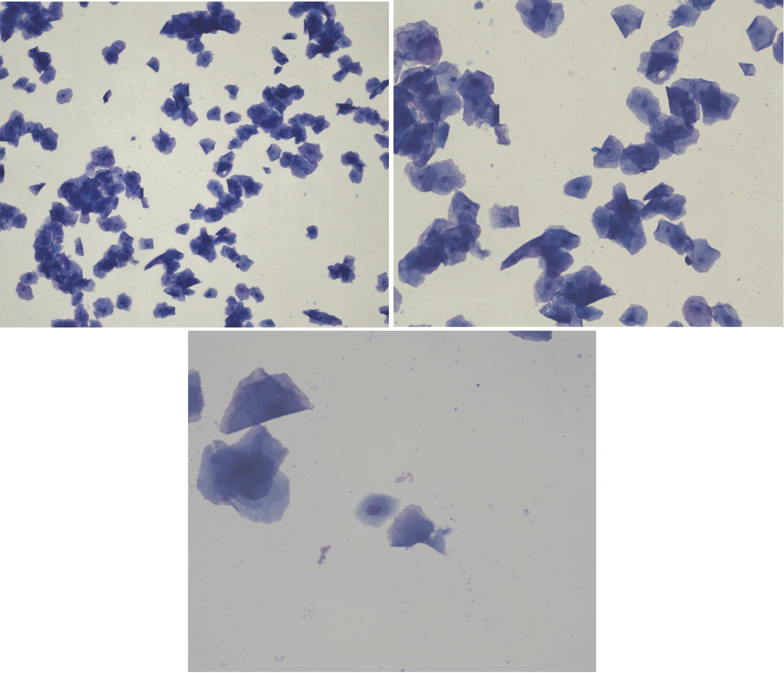 <p>Fall 2 - Michelle, Westie, ska insemineras med fryst sperma<br><br>Cellbild? Cykelstadie?</p>