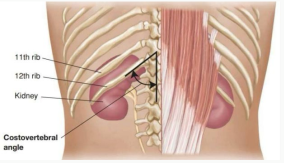 <p><strong>___ Tenderness</strong></p><p>-CVA is formed by the lower border of the ____ rib and transverse processes of the upper _______ vertebrae </p><p>-Percussing the CVA is a way to exam kidney _____________</p><p>-Do this if the kidneys were tender to palpation</p>