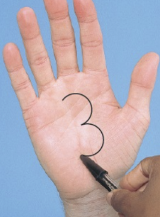 <p>number identification - with patient’s eye closed, with blunt end of pen/reflex hammer, draw large number in the patient’s palm and ask them to identify, repeat bilaterally </p>