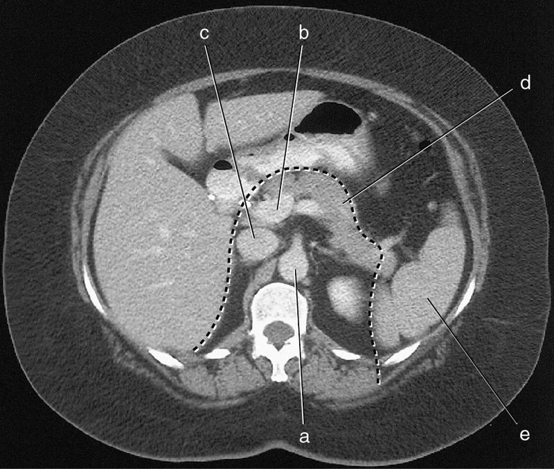 <p>spleen</p>