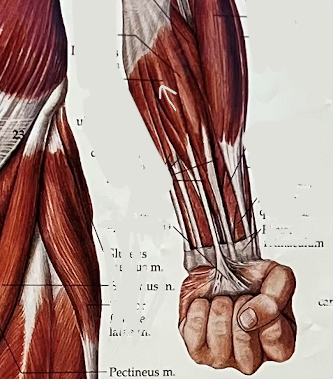 what muscle?