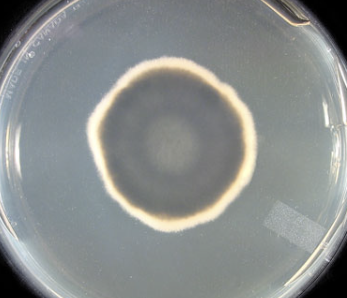 <p>What organism is this? Obverse or reverse?</p>