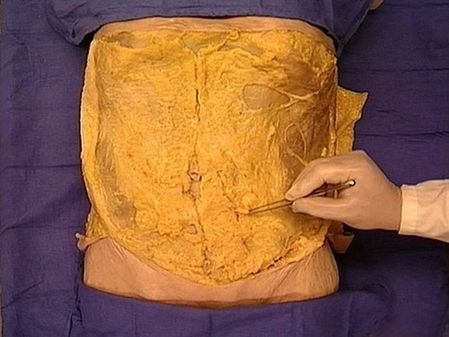 <p>loose connective tissue that underlies the skin and attaches it to the superficial layer of muscles</p>