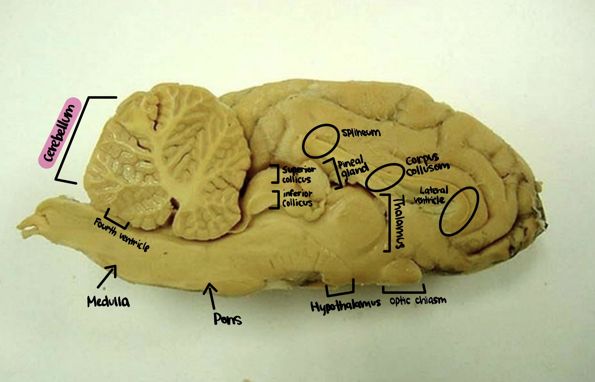 <p>Cerebellum</p>