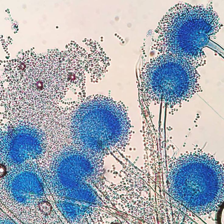 <p>Hyaline/Septate</p><p>Cinnamon-brown/white</p><p>Biseriate phialides on upper ½ of vesicle, round conidia </p>