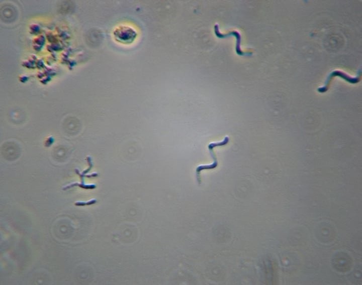 <p>spiral-shaped bacterial cells</p>