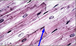 <p><span>What type of muscle tissue is this?</span></p><p><span>What is the structure indicated by the arrow?</span></p><p>Is this tissue considered striated muscle?</p><p><span>Is this tissue considered multinucleate?</span></p><p><span>Is this voluntary muscle tissue?</span></p>