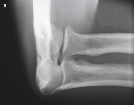 <p>What projection, position, and anatomy is this?</p>