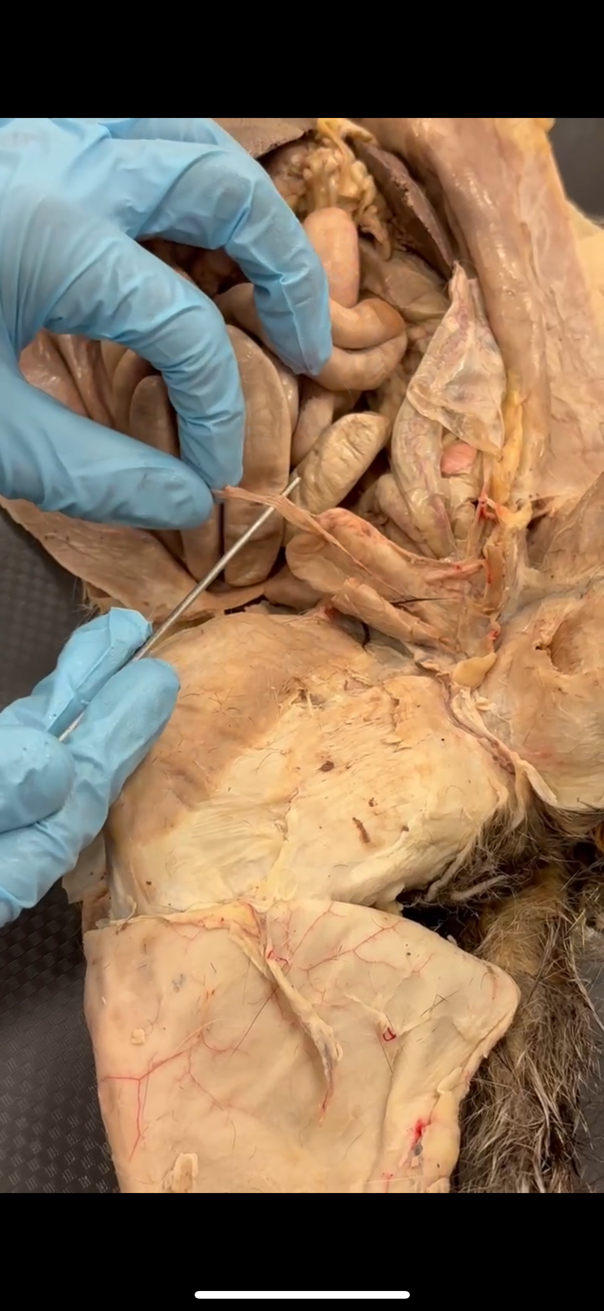 <p>Pointer hooked ligament that attaches bladder to abdominal region</p>