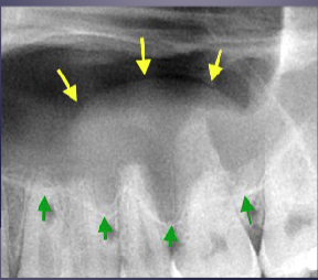 <p>what’s the pathology&nbsp;</p>