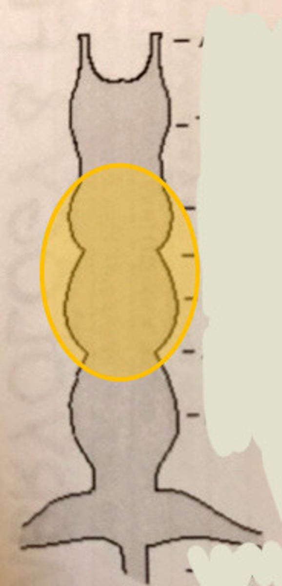 <p>What does the yellow circle indicate</p>