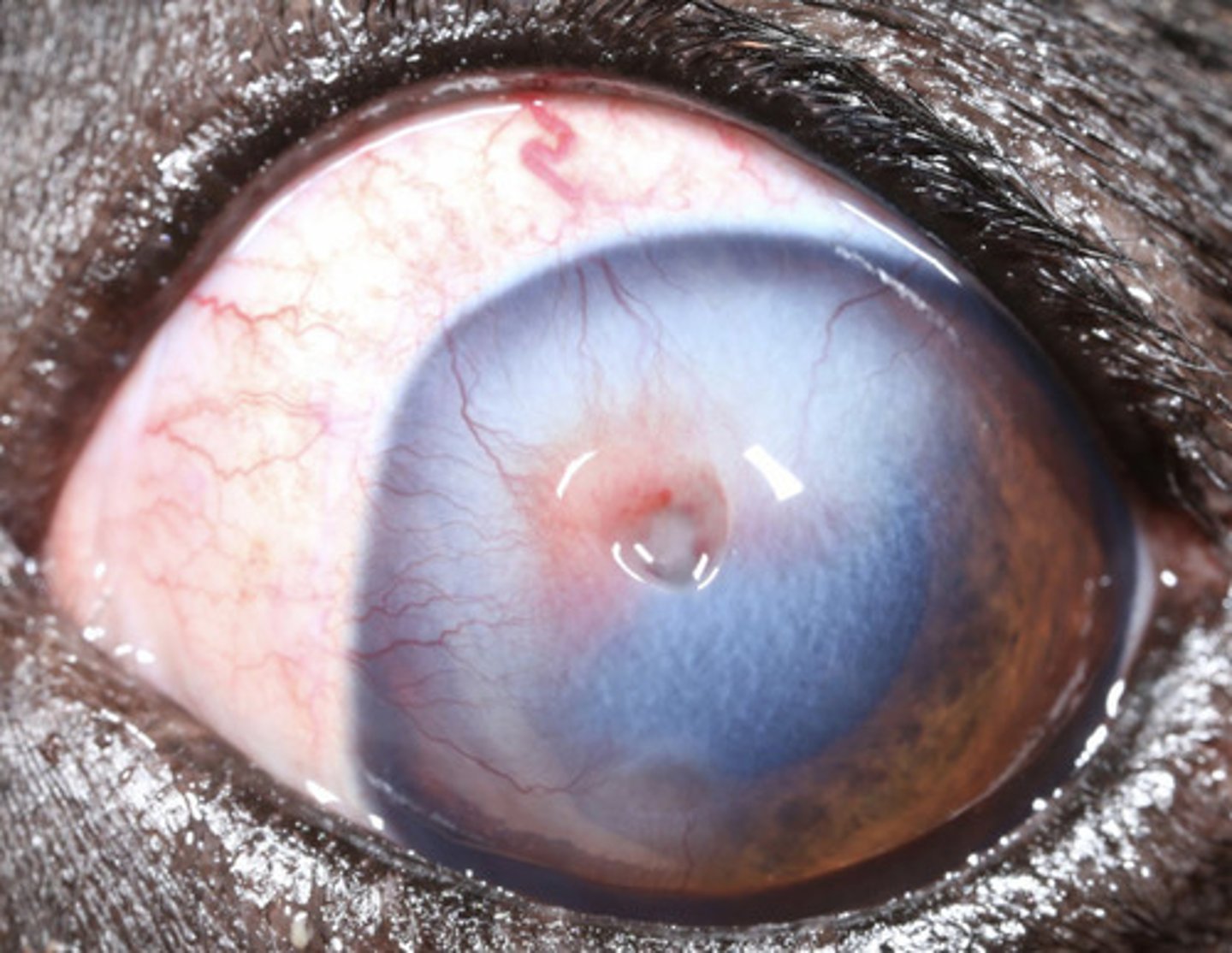 <p>What am I describing?</p><p>- Blue opacities</p><p>- Can be due to an epithelial or endothelial defect</p>