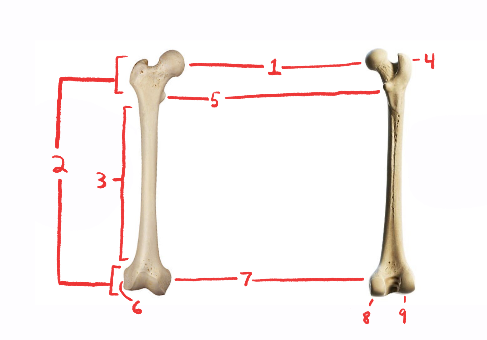 <p>What is this bone?</p>