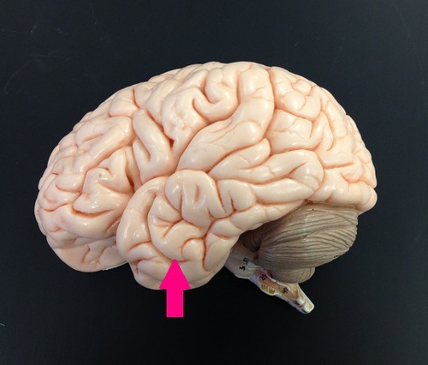 <p>Identify the lobe.</p>