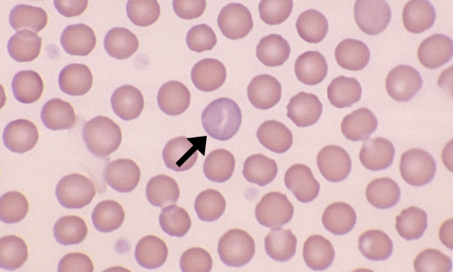 <p>Immature RBCs, no nucleus</p>