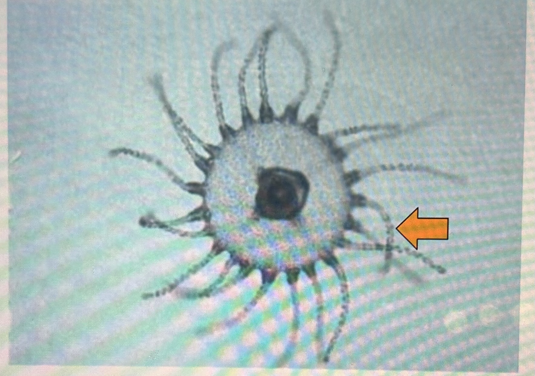 <p>What’s the arrow pointing at</p>