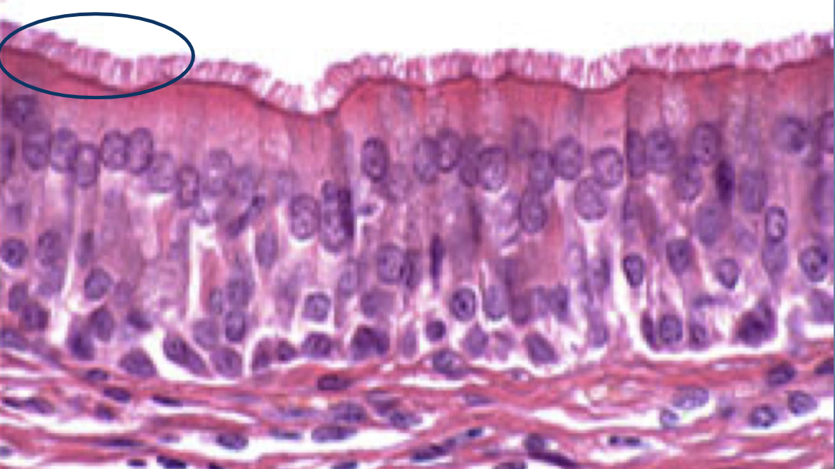 <p>What type of tissue is present in this image?</p>