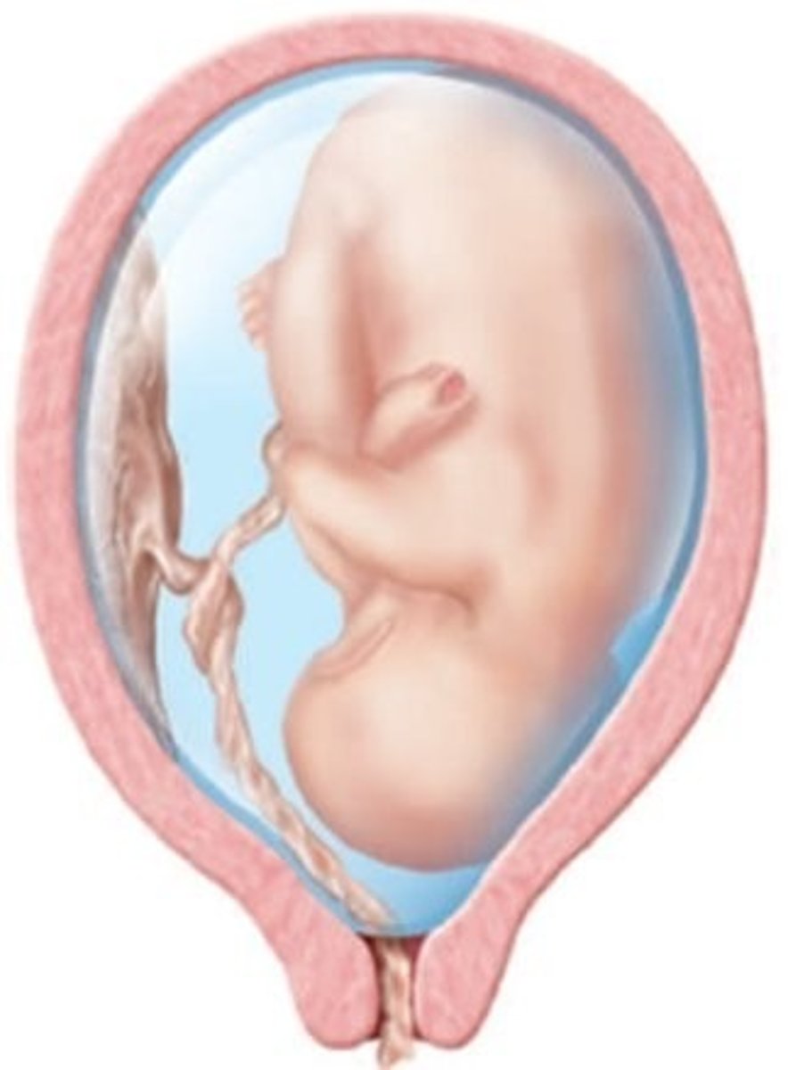 <p>40) During an intrapartum vaginal examination the following is assessed. In which position should the patient be placed at this time?</p><p>A) Supine</p><p>B) Side-lying</p><p>C) Lithotom</p><p>D) Knee-chest</p>