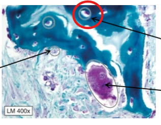 <p>Some osteoblasts that are trapped in bone and maintain matrix of bone tissue</p>