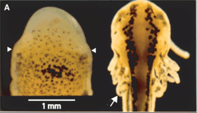 <p><span>After amputation: <strong>epidermal cell migration</strong>,</span></p><p style="text-align: left"><span>Regeneration is dependent on this.</span></p><p style="text-align: left"><span>Cell below the epithelium dedifferentiate; <strong>blastema</strong></span></p><p></p><p><span>dermis, cartilage, <strong>muscle</strong></span></p><p></p><p><span>Thrombin (protease)</span></p><p style="text-align: left"><span>Msx1</span></p><p style="text-align: left"><span>pRb phosphorylated (inactive)</span></p><p style="text-align: left"></p><p style="text-align: left"><span>Generation/regeneration:</span></p><p style="text-align: left"><span><strong>different scale</strong></span></p><p style="text-align: left"></p><p style="text-align: left"><span><strong>Very limited transdifferentiation</strong></span></p><p style="text-align: left"><span>Dermis-&gt;cartilage</span></p><p style="text-align: left"><span>Rest true to type</span></p><p></p><p><span>Lets look at amphibian/uordele limb regeneration in more detail.&nbsp; The first thing that happens fter amputation is that&nbsp; the epidermal cells migrate over wound surface, this is essential for regeneration to occur.</span></p><p style="text-align: left"><span>&nbsp;</span></p><p style="text-align: left"><span>To continue with the process of regeneration once the epithelium has covered the wound, cell below this epithelium dedifferentiate and form a blastema</span></p><p style="text-align: left"><span>The blastema is derived from the dermis but also from dedifferentiating muscle and cartilage.</span></p><p style="text-align: left"></p><p style="text-align: left"><span>The fact that the muscle can also participate is quite surprising since muscle cells are multinucleate.&nbsp; It has been found that multinucleate muscle cells can revert to mononucleate cells in cell culture under the influence of thrombin, which is a protease.&nbsp; Dedifferentiation of muscle cells involves expression of msx a homeobox transcription factor, and inactivation of the Rb gene (by phosphorylation), which inhibits proliferation of muscle under normal circumstances. The presence of thrombin is is crucial for dedifferentiation and may have wider significance, lens regeneration also requires local activation of thrombin.</span></p><p style="text-align: left"></p><p style="text-align: left"><span>It is important to realise that generation of a limb during embryogenesis and regeneration must be different, the figure over here shows a limb bud on the right (white arrow) and a regenerating limb (between white arrowheads on left) , as you can see in the figure, the scale is quite different. Thus if morphogens are involved, they somehow need to work over a 10x larger range, it is hard to imagine how this would work molecularly, although there may be lots of parallels, there must also be differences.</span></p><p style="text-align: left"></p><p style="text-align: left"><span>An interesting question that can be posed is that if cells are dedifferentiating, to what extend are they dedifferentiated, if they were muscle cells can they suddenly give rise to dermis? Or can a dedifferentiated cartilage cell give rise to muscle? People have done experiments to look at&nbsp; this and the consensus is that there is very little transdifferention, dermis cells appear to be able to give rise to cartilage but the rest is,&nbsp; to all intents and purposes, true to type, so dedifferentiation is very limited.</span></p><p></p>