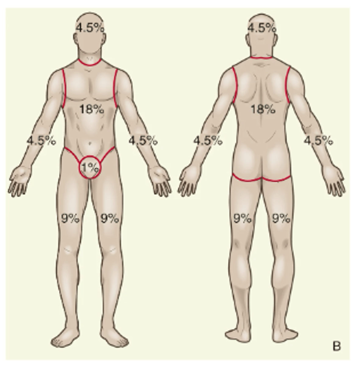 <p>- Easy to remember, is considered adequate for initial assessment of an adult patient with burn injury</p><p>- For irregular or odd-shaped burns, the size of the patient's hand (including the fingers) is approximately 1% TBSA</p>