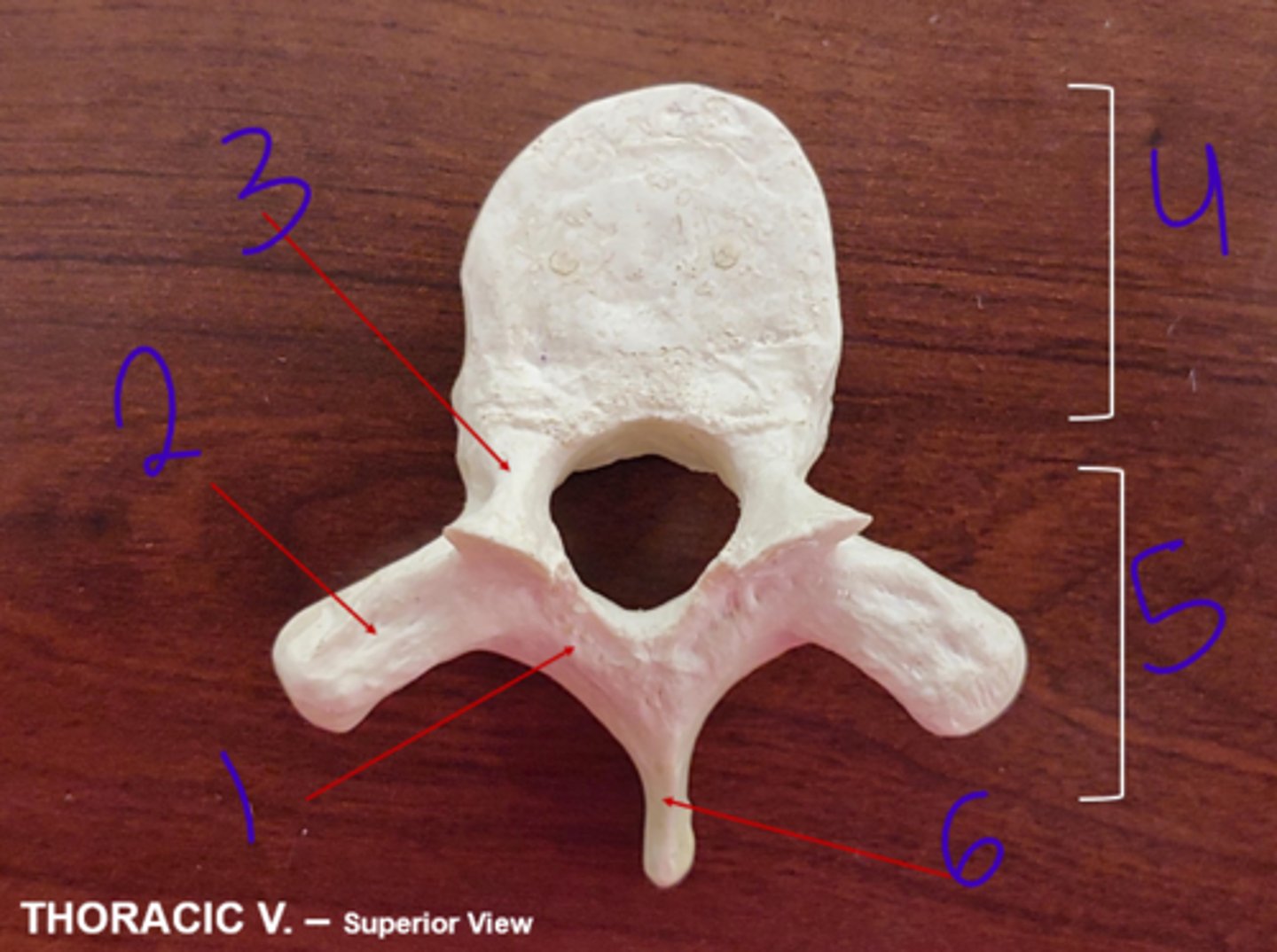 <p>Thoracic - #3</p>
