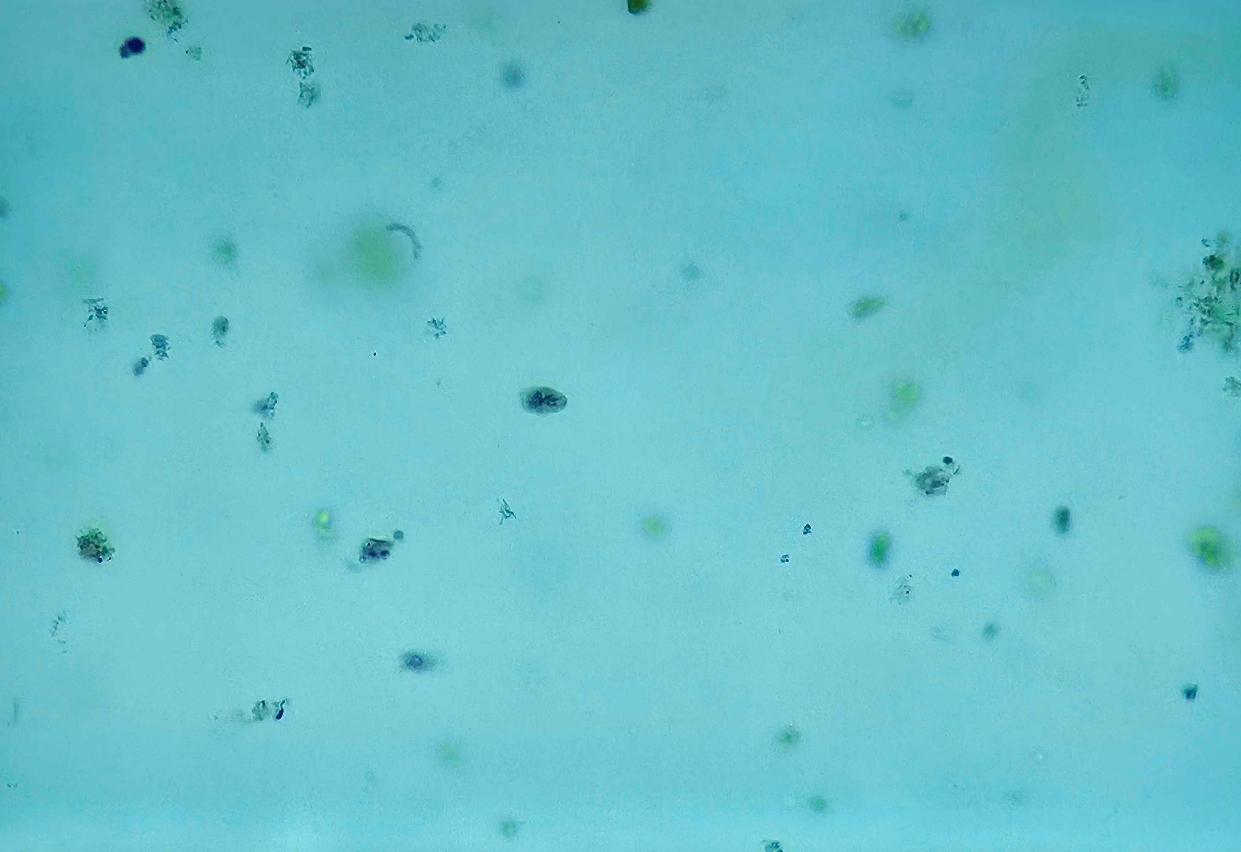 <p><span data-name="microscope" data-type="emoji">🔬</span><span data-name="petri_dish" data-type="emoji">🧫</span><strong><span> </span>Na podstawie zdjęcia preparatu:</strong></p><p></p><ul><li><p><span data-name="book" data-type="emoji">📖</span><span> </span>rozpoznaj gatunek pasożyta;</p></li></ul><p></p><ul><li><p><span data-name="recycle" data-type="emoji">♻</span><span> </span>rozpoznaj wszystkie formy rozwojowe;</p></li></ul><p></p><ul><li><p><span data-name="microbe" data-type="emoji">🦠</span><span> </span>wskaż organelle i cechy charakterystyczne dla danego gatunku;</p></li></ul><p></p><ul><li><p><span data-name="mask" data-type="emoji">😷</span><span> </span>nazwij chorobę, którą pasożyt wywołuje.</p></li></ul><p></p>