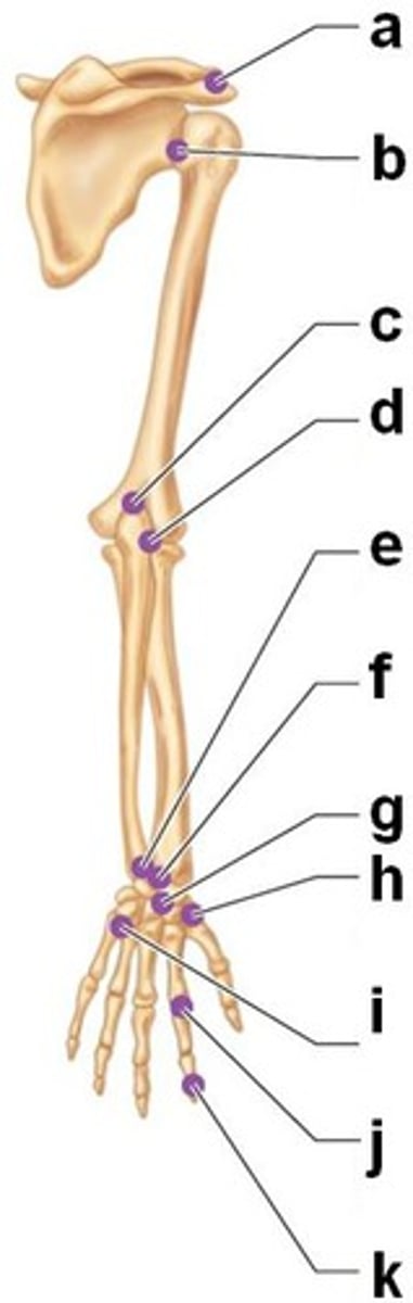 <p>freely movable joints; also known as synovial joints</p>