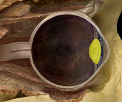 term image