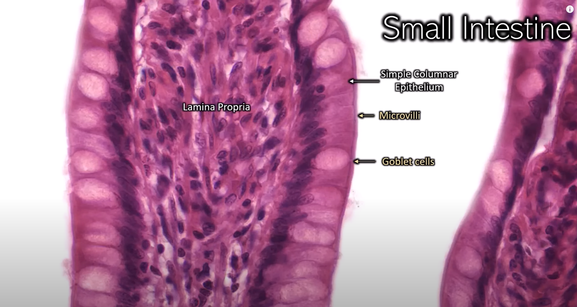 <p>Structure: Villi</p><p>Commonly found in the intestine, especially small</p><p>Inner space is lamina propria that epithelium border is attached to</p><p>Clear cup cells: Goblet cells (this is an image of small intestine)</p>
